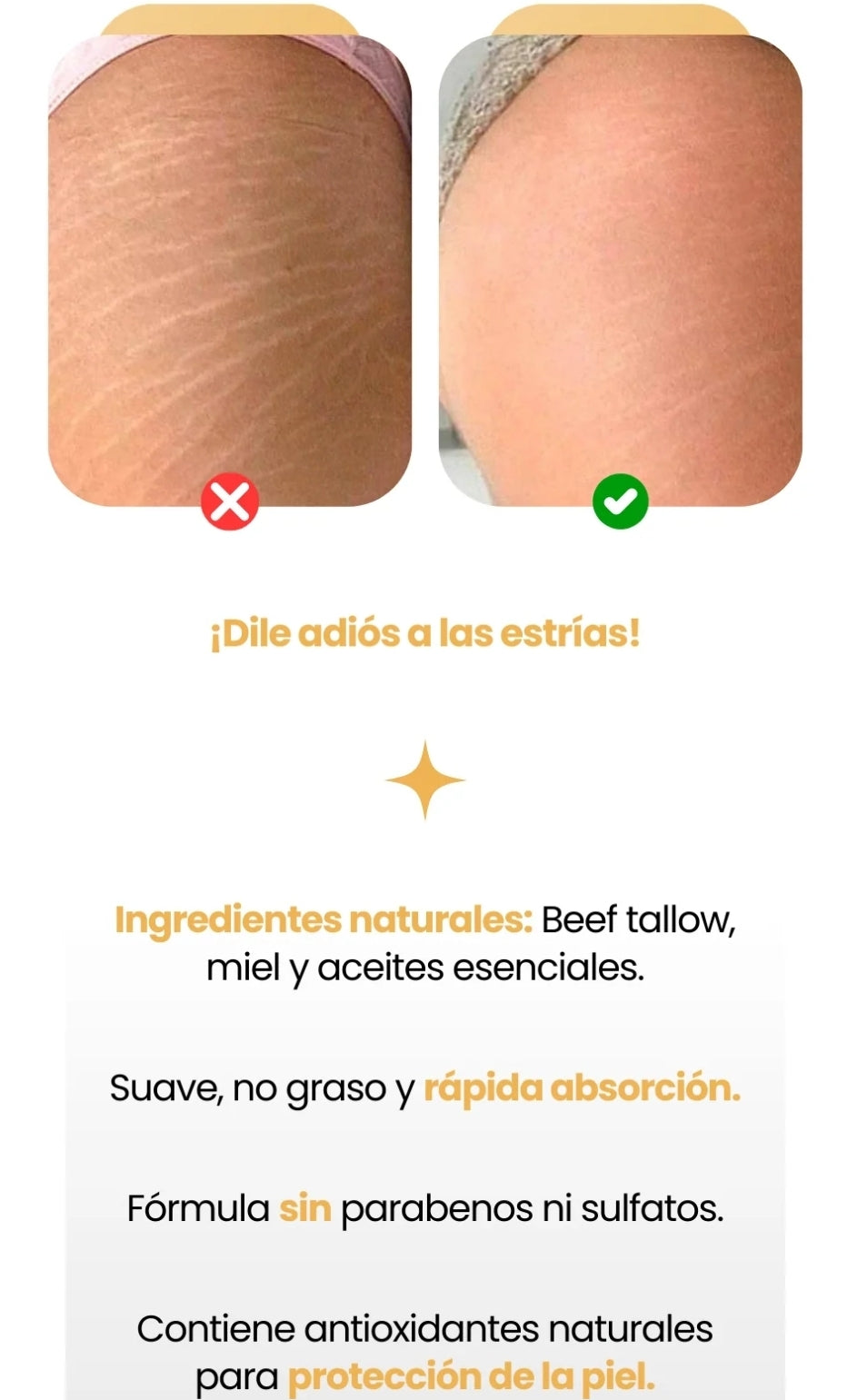 Bálsamo Orgánico de Sebo de Res y Miel-Elimina estrías, acné y líneas de expresión en segundos