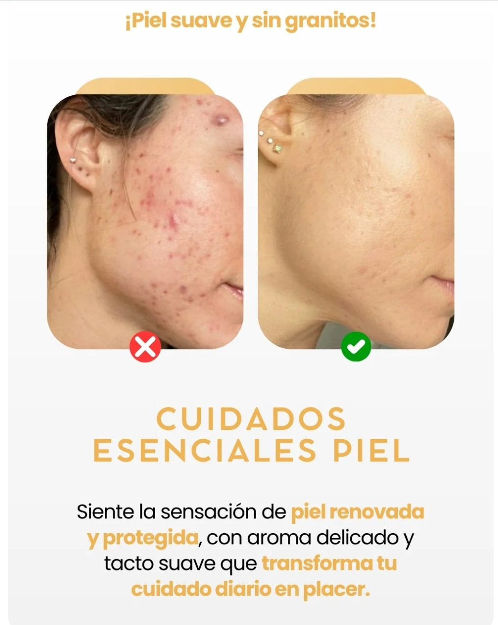 Bálsamo Orgánico de Sebo de Res y Miel-Elimina estrías, acné y líneas de expresión en segundos