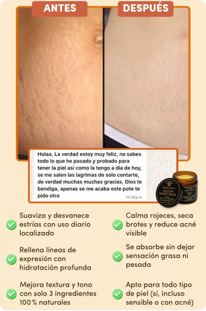 Bálsamo Orgánico de Sebo de Res y Miel-Elimina estrías, acné y líneas de expresión en segundos