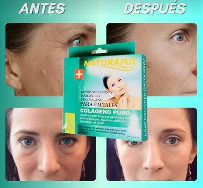 NaturalFul® Parches De Colágeno Absorbentes Milagrosos ✨❤️ + ENVÍO GRATIS 🚚