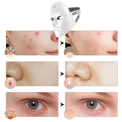 MÁSCARA FACIAL CON LUZ LED