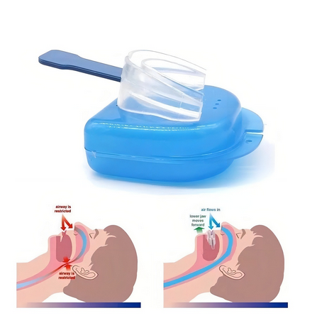 Placa Antibruxismo Anti Apnea Y Antironquidos