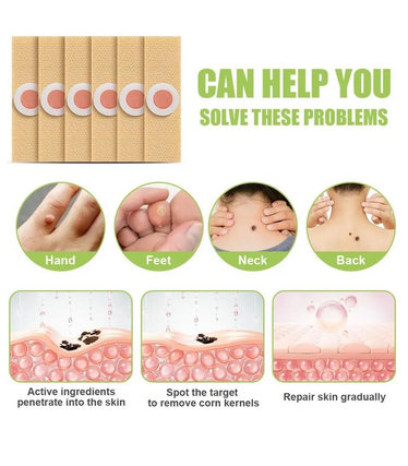 20 Parches Removedor De Callos Y Verrugas Alivia Dolor Sin Aroma